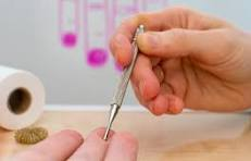 Sujok therapy image 2