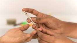 Sujok therapy image 3