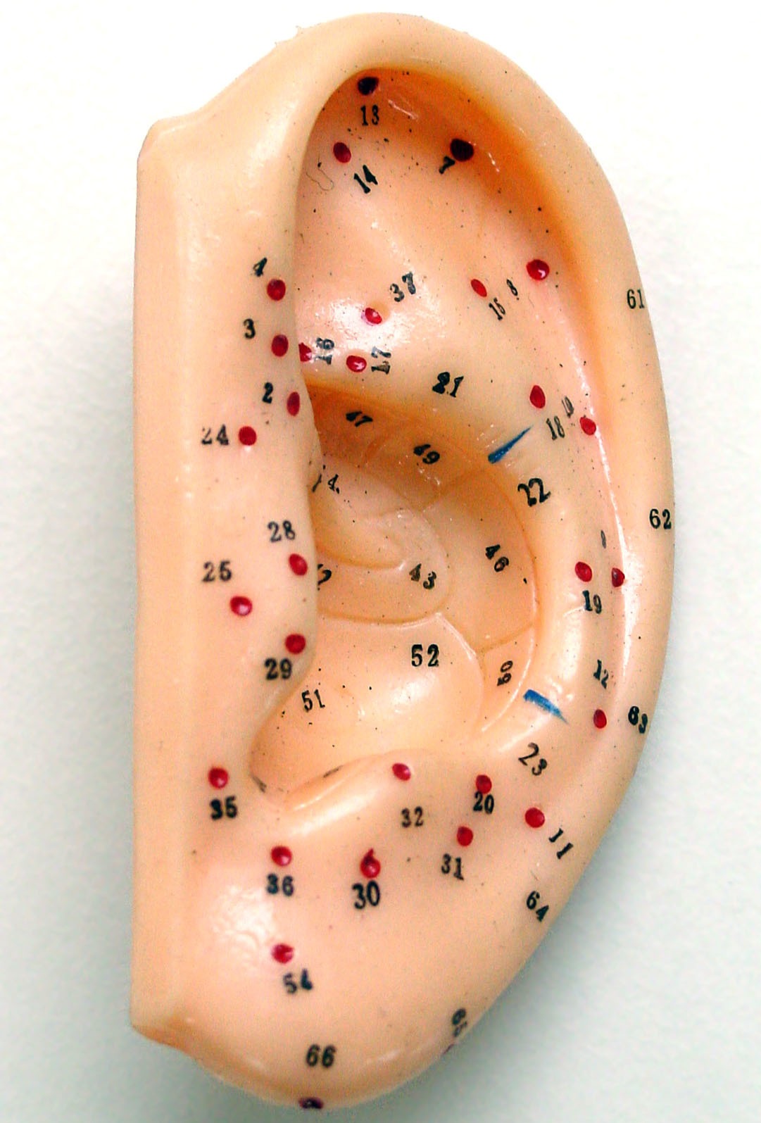 Auricular therapy image 3